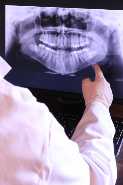 Best Emergency Dental Services for Seniors in Merchantville, NJ
