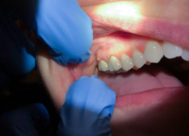 Best Weekend Emergency Dentist in Merchantville, NJ
